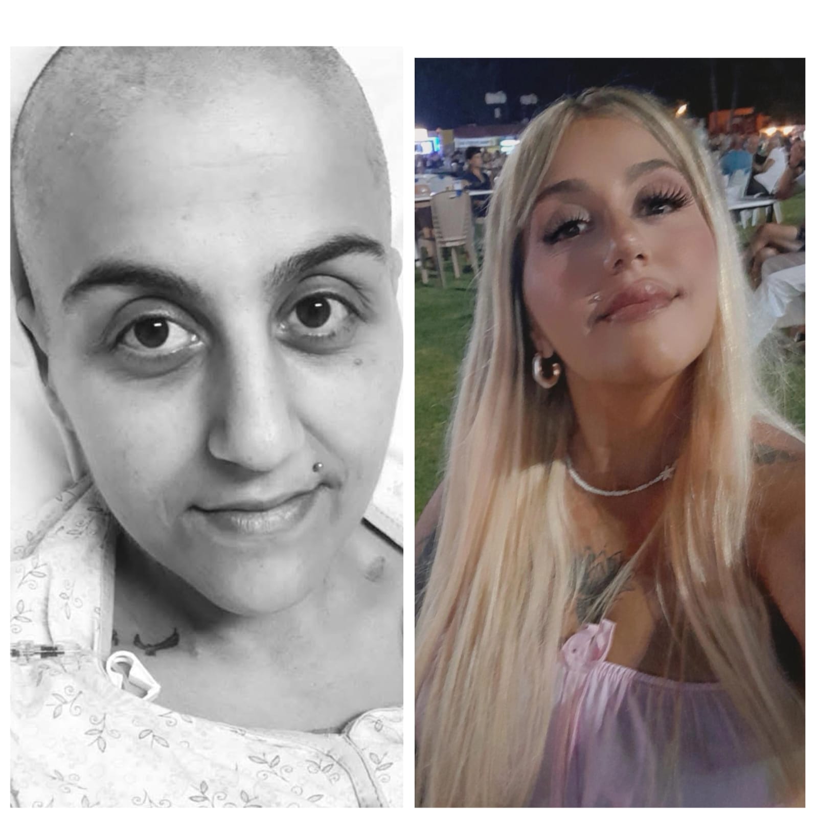 9 kez kanseri yendi, iki kere nakil oldu: Aysel Gürtay’ın hikayesi kanser hastalarına umut oldu