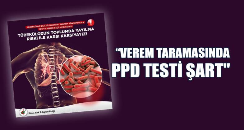 Kıbrıs Türk Tabipleri Birliği: Verem Taramasında PPD Testi Şart